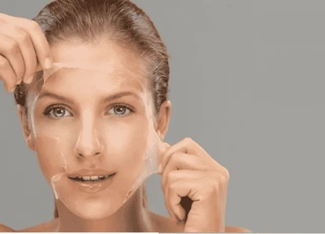 Chemical Peels